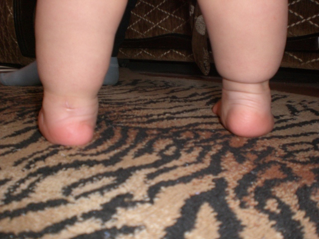 Почему дети поджимают ноги. Ребенок подгибает пальцы на ногах. Ребенок поджимает пальчики на ногах при ходьбе. Ребенок поджимает пальчики на ногах в 1.5 года. Ребенок в 7 месяцев поджимает пальцы ног.