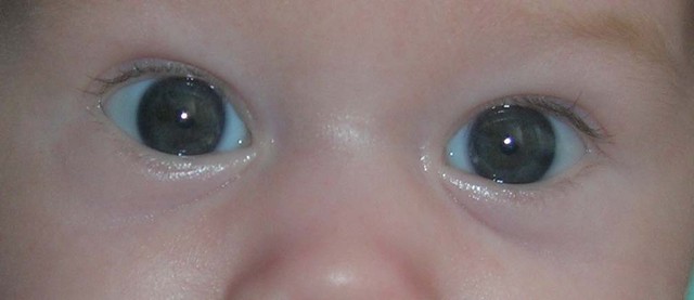 До скольки меняются глаза. Цвет глаз у новорожденных. Графитовый цвет глаз у новорожденных детей. Цвет глаз у новорожденных в 1 месяц. Смена цвета глаз у новорожденных.