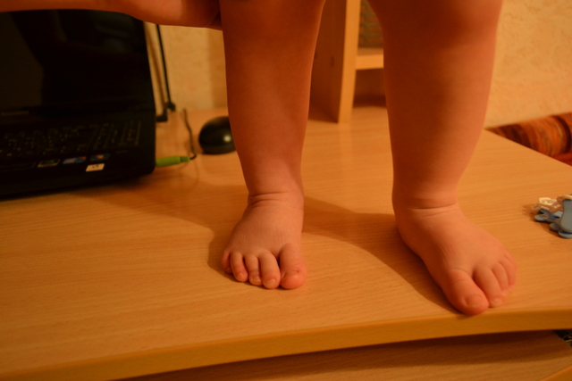 Рука нога когда у ребенка. Ребенок подгибает пальцы на ногах. Поджимает пальчики на ногах. Гипертонус ног у ребенка. Кривые ножки у новорожденного.